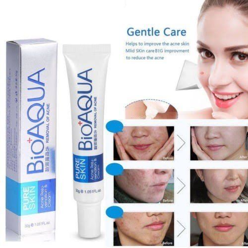 Anti Acne Cream